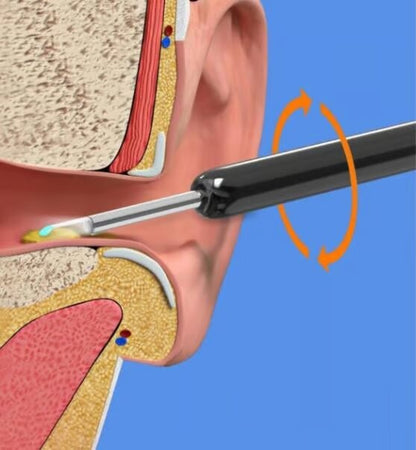 🔥Wireless WIFI Visual Ear Pick🔥