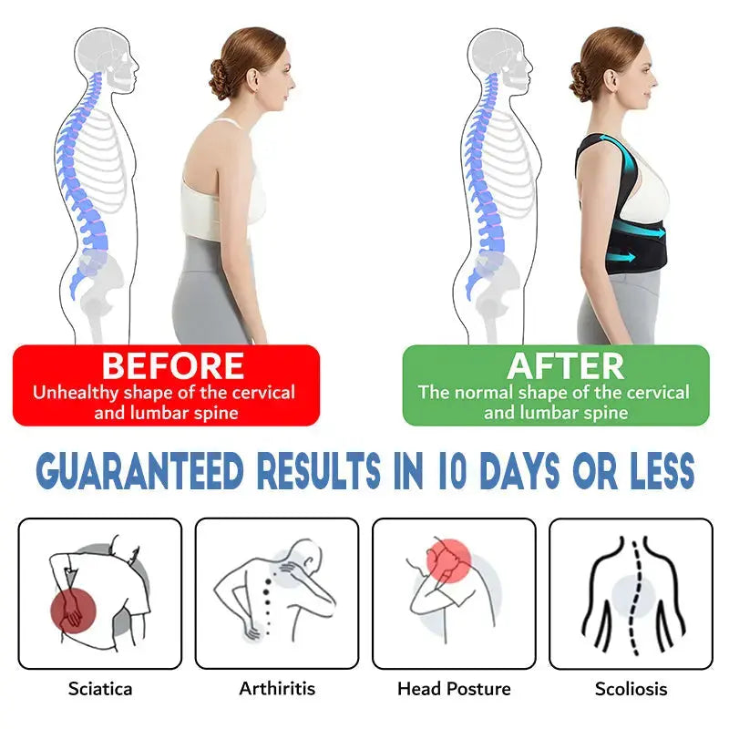 🔥Last Day 70% OFF🔥Instant Posture Corrector